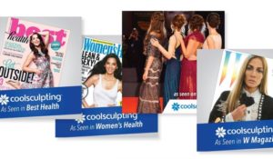coolsculpting in the media