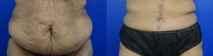 Fleur de lis before and after