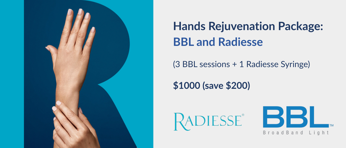 Hands rejuvenation package with BBL and Radiesse.