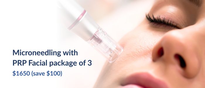 Microneedling with PRP Facial package of 3.